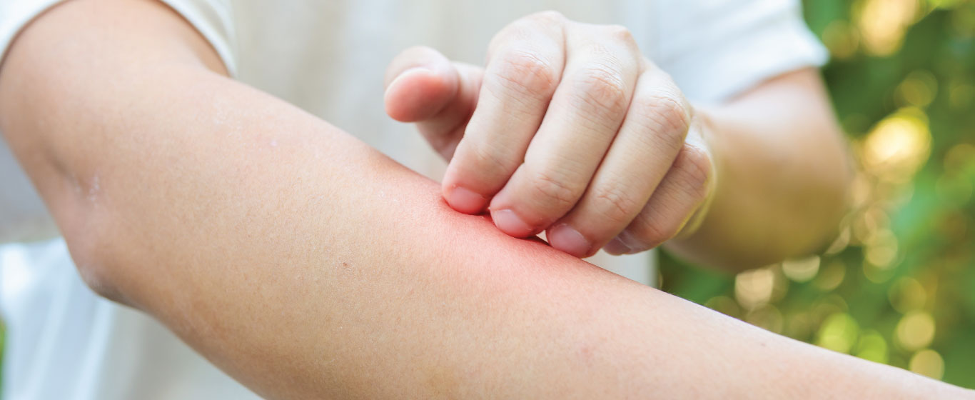 Person scratching his arm