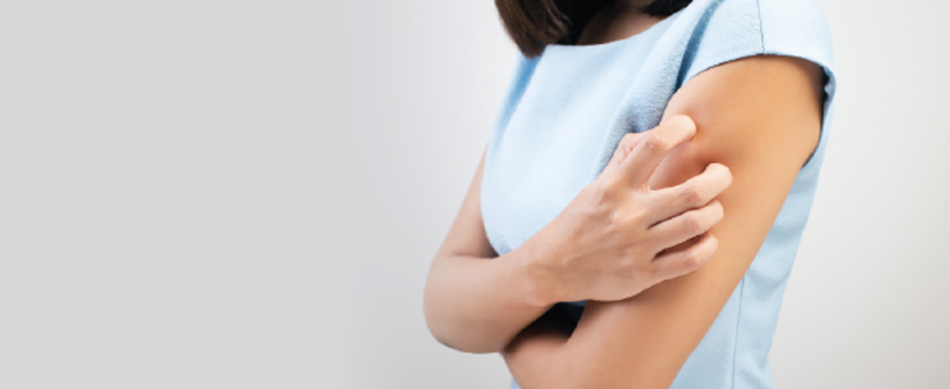 woman-scratching-arm